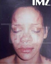 Πήρε το αίμα της πίσω η Rihanna