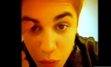 Justin Bieber: Παρέλυσε το φρύδι του από την διάσειση