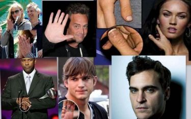 Οι φυσικές ατέλειες των σταρ του Χόλιγουντ: Έξι δάχτυλα, σιαμαίοι, κομμένα άκρα…