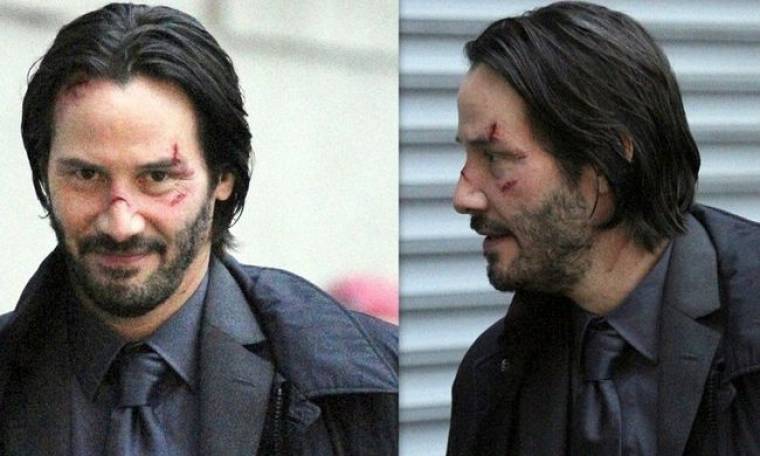 Με ράμματα, σπασμένη μύτη και τραύματα στο πρόσωπο ο Keanu Reeves!