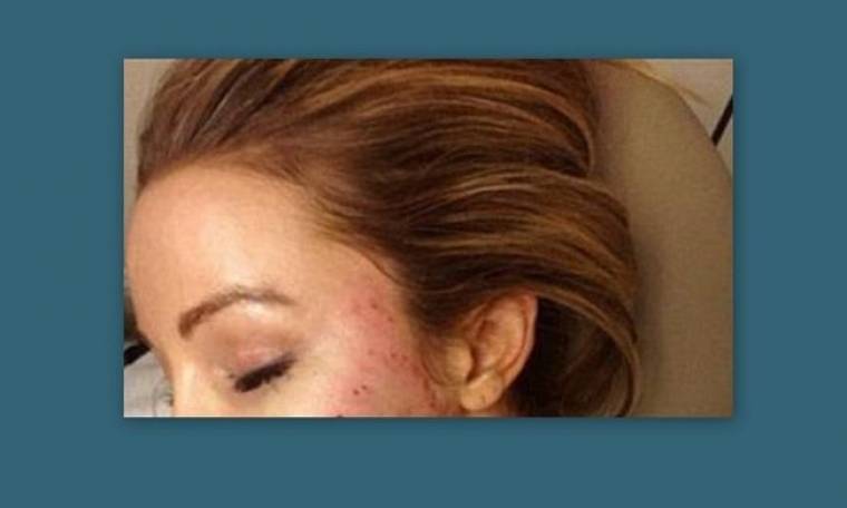 Πόσταρε το πρόσωπό της με αίμα στο Instagram (σοκαριστική φωτό)