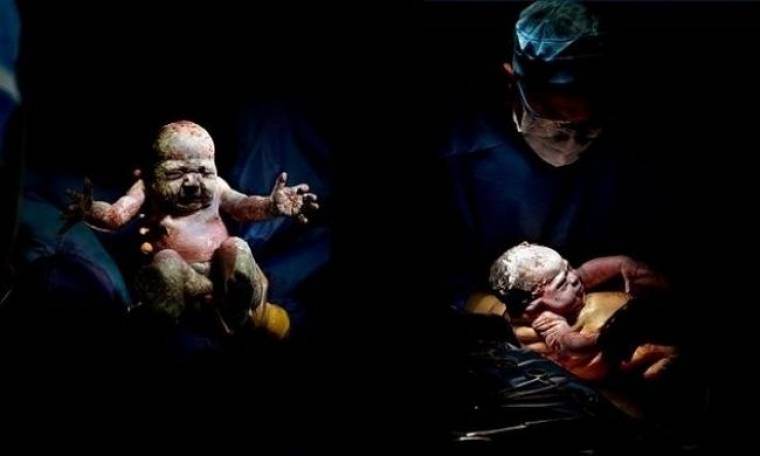 Συγκλονιστικό: Μοναδικά πορτρέτα μωρών λίγα δευτερόλεπτα μετά τη γέννησή τους (εικόνες)
