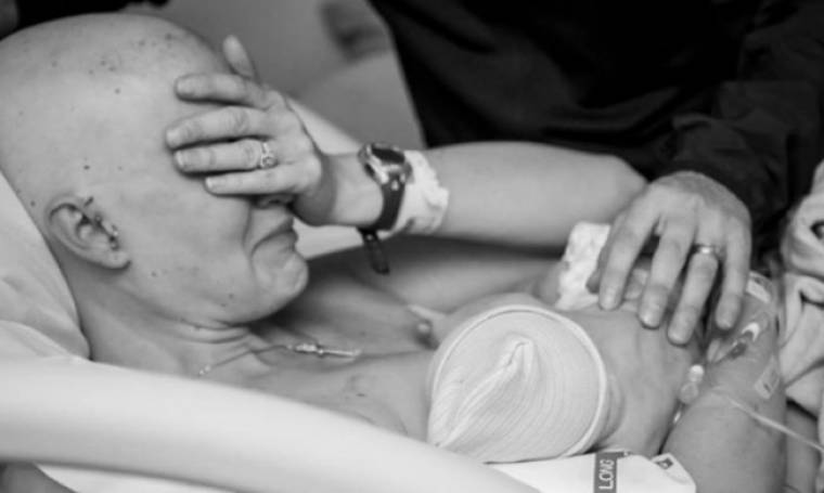 Οι viral φωτογραφίες της μητέρας που θηλάζει μετά από μαστεκτομή