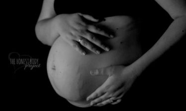 Μέλλουσες μανούλες μας δείχνουν πώς είναι πραγματικά το γυναικείο σώμα στην εγκυμοσύνη (εικόνες)