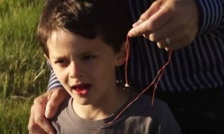 Πατέρας τράβηξε το δόντι του παιδιού του-Ούτε που περνάει το μυαλό σας τι χρησιμοποίησε (βίντεο)