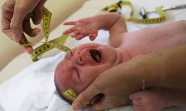 Γεννήθηκε μωρό με μικροκεφαλία στο Νιου Τζέρσεϊ των ΗΠΑ