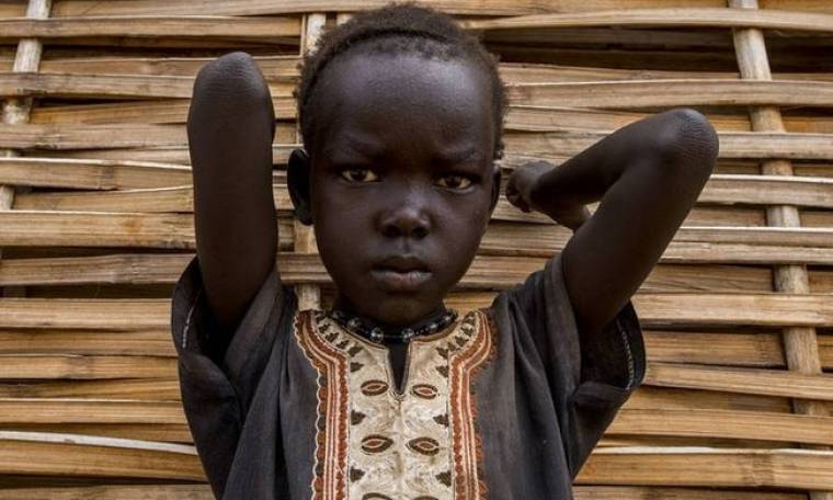ΟΗΕ: 56 εκατ. άνθρωποι στο φαύλο κύκλο βίας και πείνας