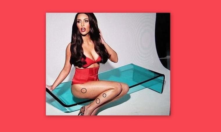«Μάχη» με τη ψωρίαση δίνει η Kim Kardashian