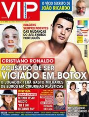 Εθισμένος στα botox ο Cristiano Ronaldo;