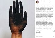 Σταματίνα Τσιμτσιλή:«Νιώθω θυμωμένη που το 2018 τόσοι συνάνθρωποι μου κάηκαν ζωντανοί…»