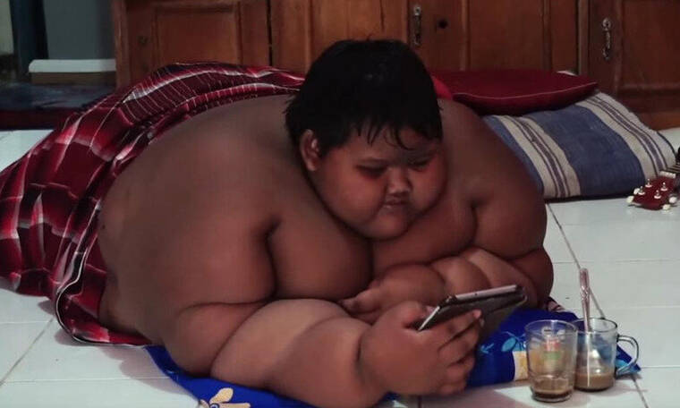 To πιο «χοντρό παιδί του κόσμου», αδυνάτισε! Έχασε 100 κιλά και είναι αγνώριστο (Photos)