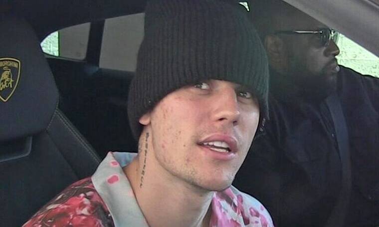 Justin Bieber: Θρίλερ με την υγεία του- Η ασθένεια από την οποία πάσχει και το μήνυμά του