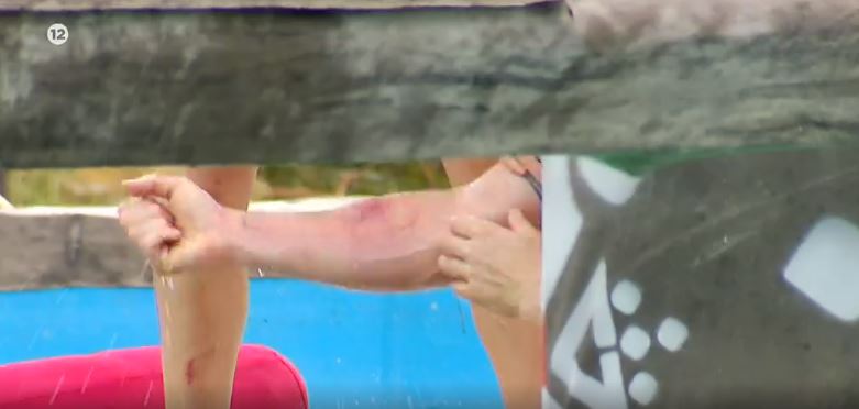 Survivor: «Άφωνοι» οι παίκτες με τον σοβαρό τραυματισμό του Τάκη Καραγκούνια