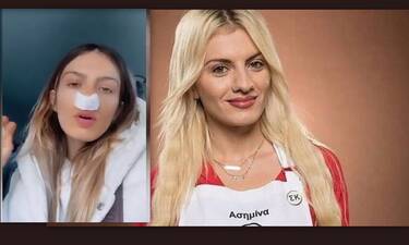 Ασημίνα Ουστάλλι: Το τρίτο χειρουργείο στη μύτη – «Δε μπορώ να αναπνεύσω καθόλου»