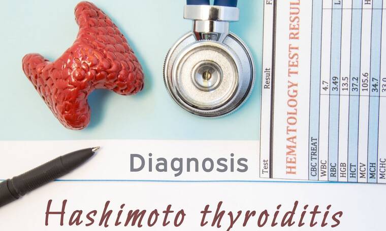 Θυρεοειδίτιδα Hashimoto: Τι περιλαμβάνει η διατροφή για τη διαχείριση των συμπτωμάτων (εικόνες)