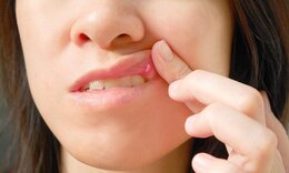 Ανεπάρκεια βιταμίνης Β12: Οι αλλαγές στο στόμα που πρέπει να σας θορυβήσουν